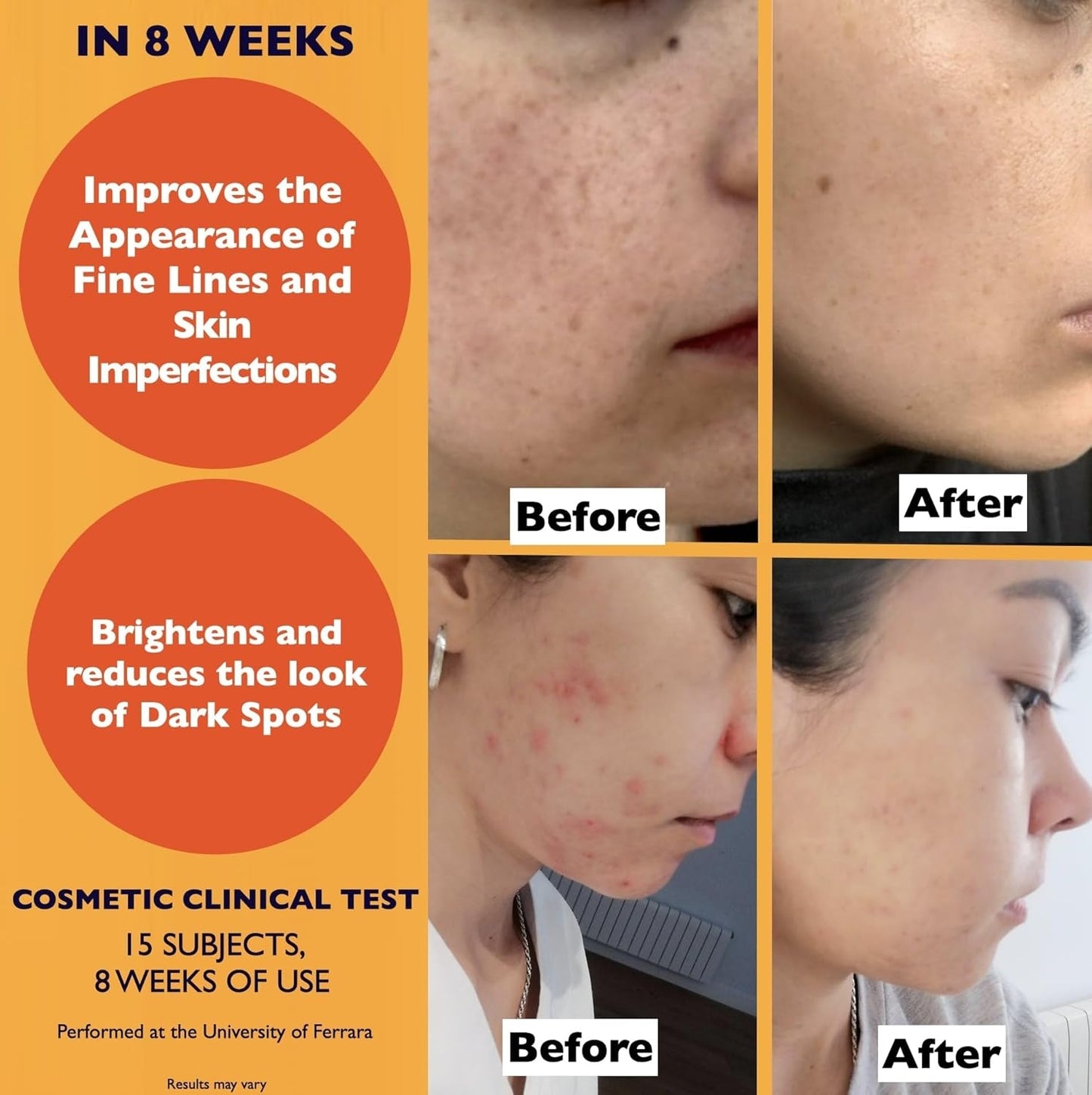 Organic Vitamin C Serum for Face 2.11oz | Anti-Aging & Brightening Serum | Dark Spot & Wrinkle Repair