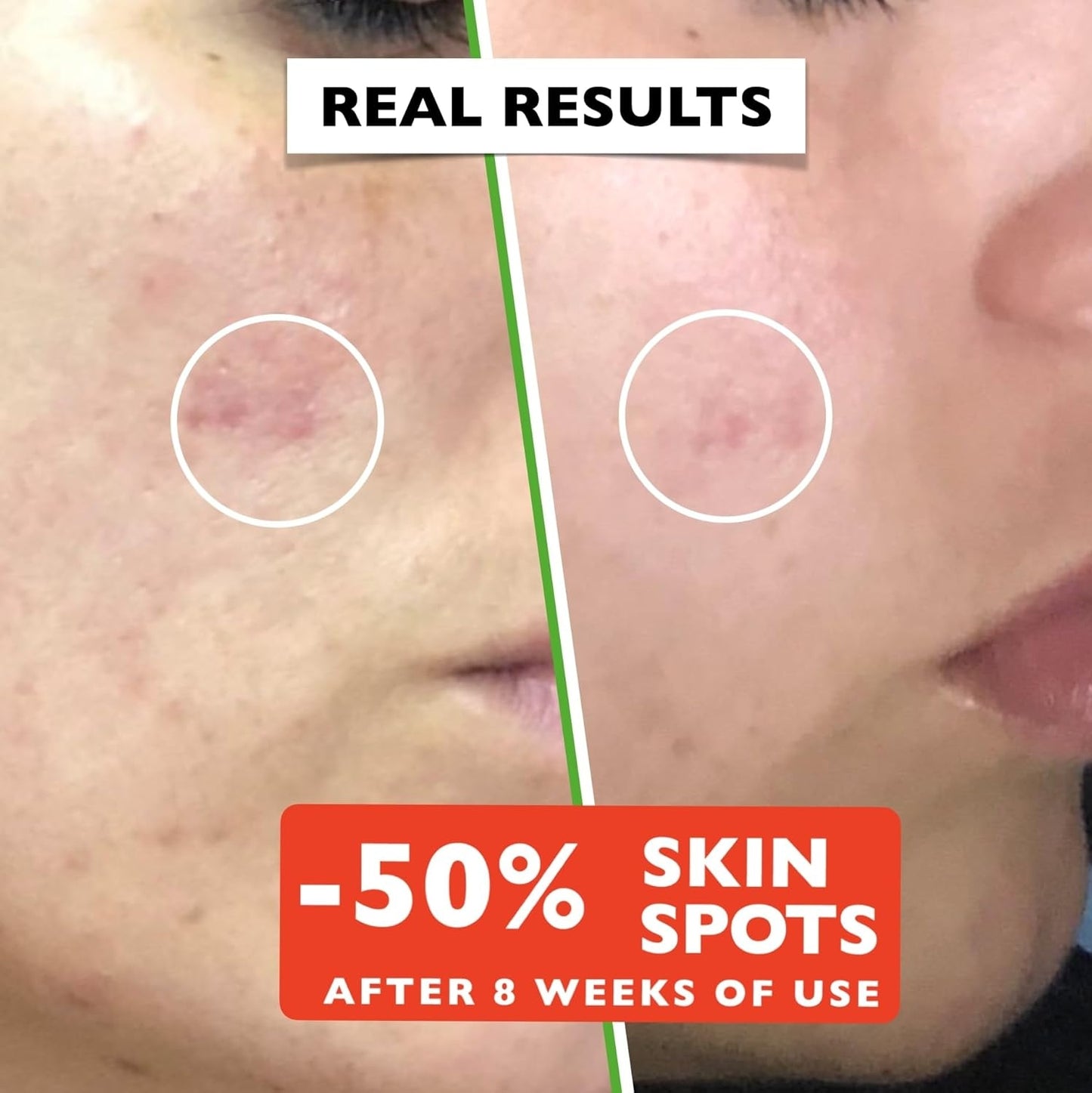 Organic Vitamin C Serum for Face 2.11oz | Anti-Aging & Brightening Serum | Dark Spot & Wrinkle Repair