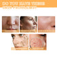 Glycolic Acid 7% Toner Acne Pimple Scar Treatment Pore Minimizer Exfoliation Boosting Collagen Reduce Wrinkles Moisturize Toner