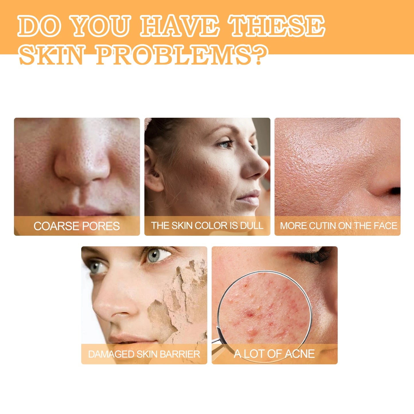Glycolic Acid 7% Toner Acne Pimple Scar Treatment Pore Minimizer Exfoliation Boosting Collagen Reduce Wrinkles Moisturize Toner