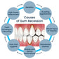 Rapid Repair Gums Gel Effectively Relieve Tooth Allergy Dental Caries Tooth Cleaning Toothpaste Relieve Tooth Damage Serum
