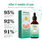 Gum Repair Drops Relieve Receding Gingival Swelling Gum Cleaning Care Oral Periodontal Hygiene Remove Yellow Remove Stain