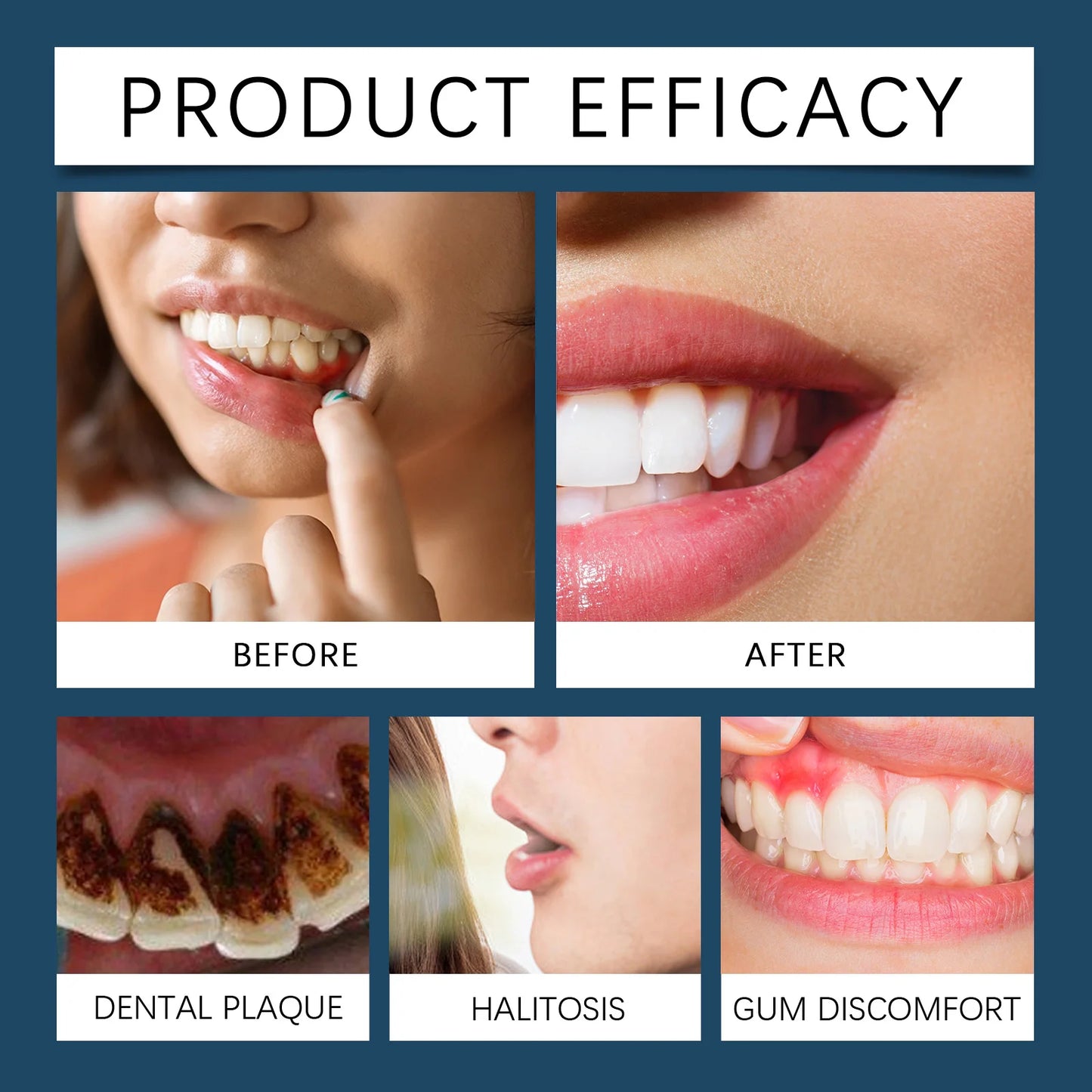 Rapid Repair Gums Gel Effectively Relieve Tooth Allergy Dental Caries Tooth Cleaning Toothpaste Relieve Tooth Damage Serum