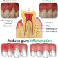 Rapid Repair Gums Gel Effectively Relieve Tooth Allergy Dental Caries Tooth Cleaning Toothpaste Relieve Tooth Damage Serum