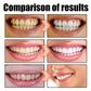 Gum Repair Drops Relieve Receding Gingival Swelling Gum Cleaning Care Oral Periodontal Hygiene Remove Yellow Remove Stain
